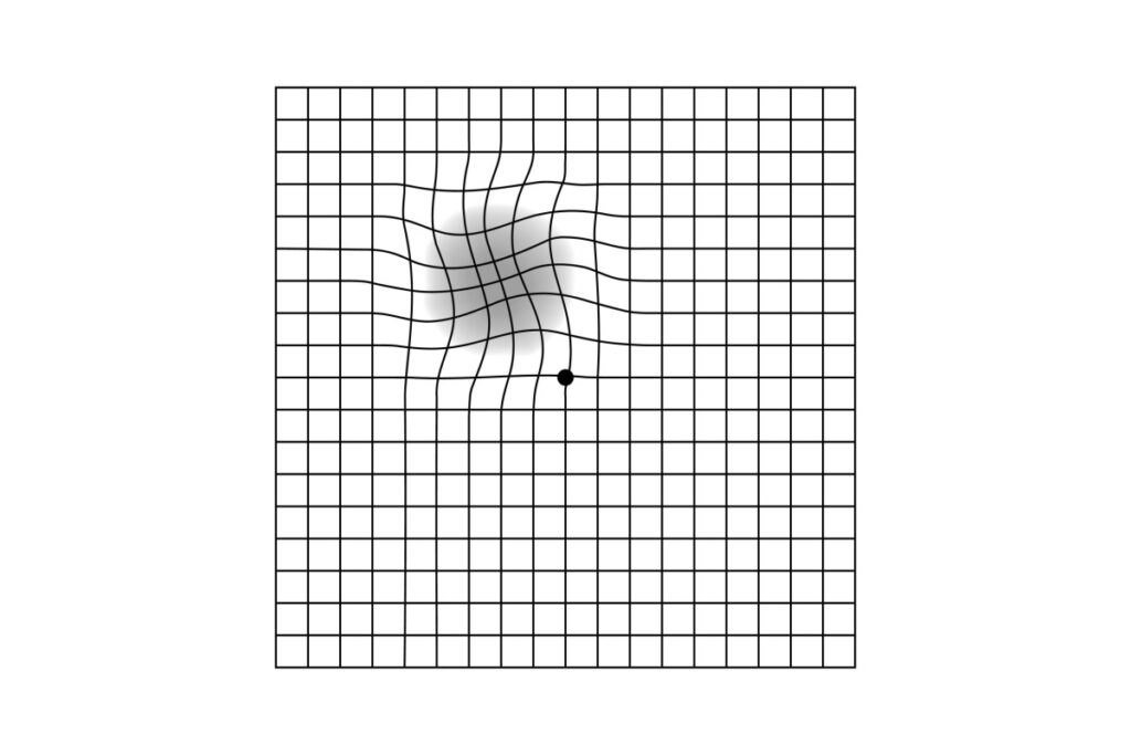 Amsler grid showing wavy sections